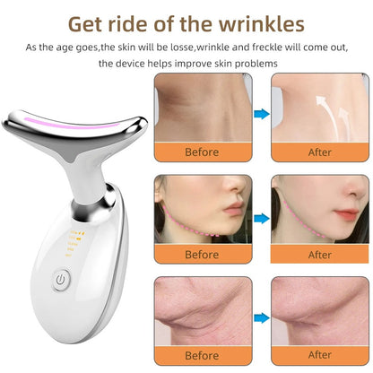 NuovaCell® Anti-Aging Facial Lifting Device with EMS, Vibration & Heat Therapy
